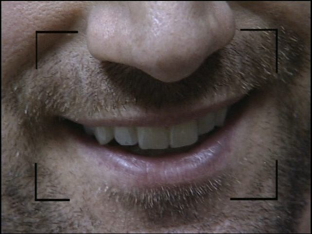 cap038